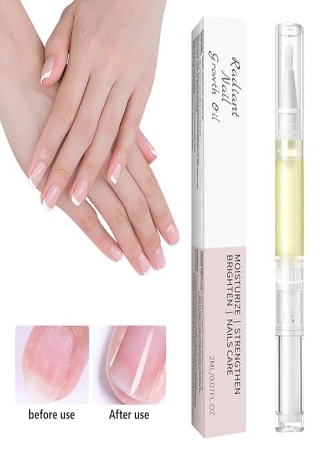 YILEST Cuticle Oil Pen for Nail Care – Nourishing Cuticle Revitalizer with Natural Oils, Hydrating & Quick-Absorbing, Mess-Free Applicator, Perfect for At-Home & Salon Use-2PCS - Image 4